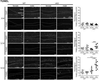 Estradiol Inhibits ER Stress-Induced Apoptosis in Chondrocytes and Contributes to a Reduced Osteoarthritic Cartilage Degeneration in Female Mice